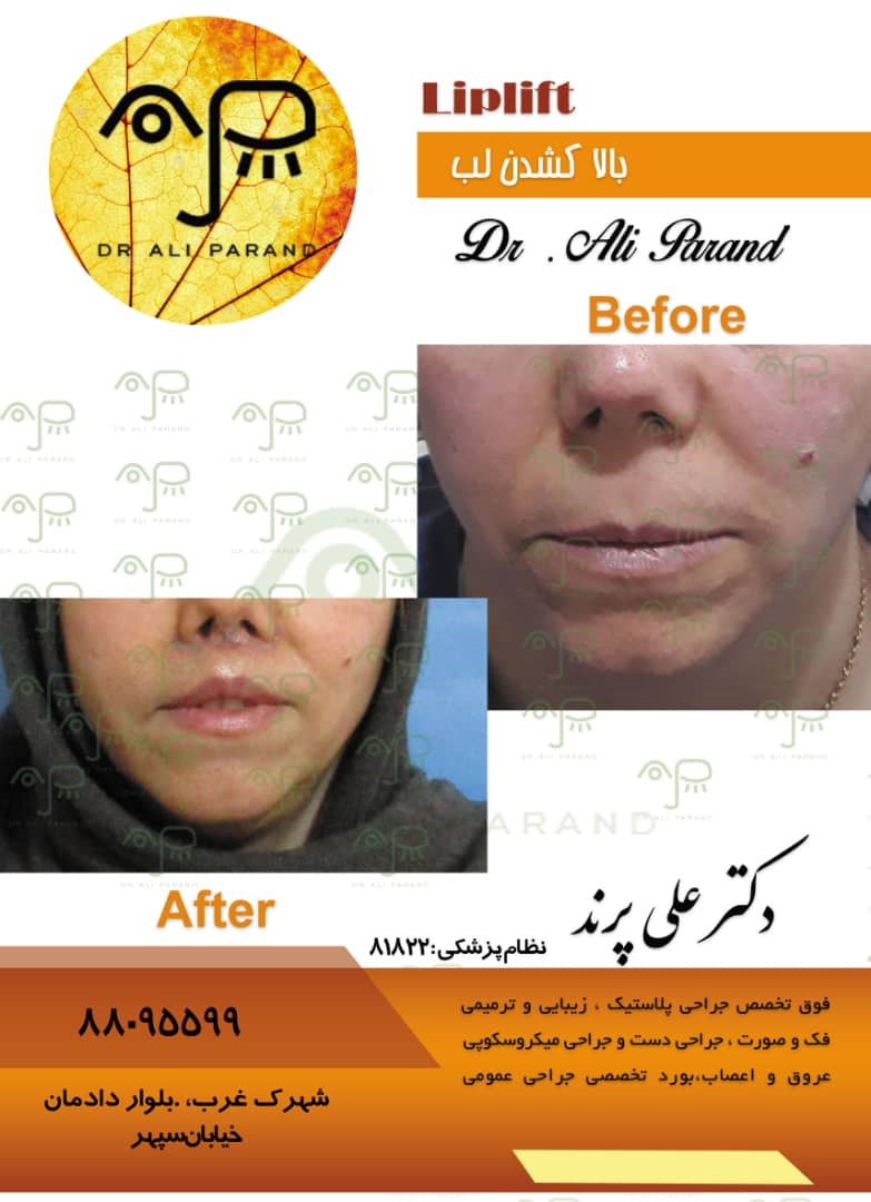 Doctoryab Iran