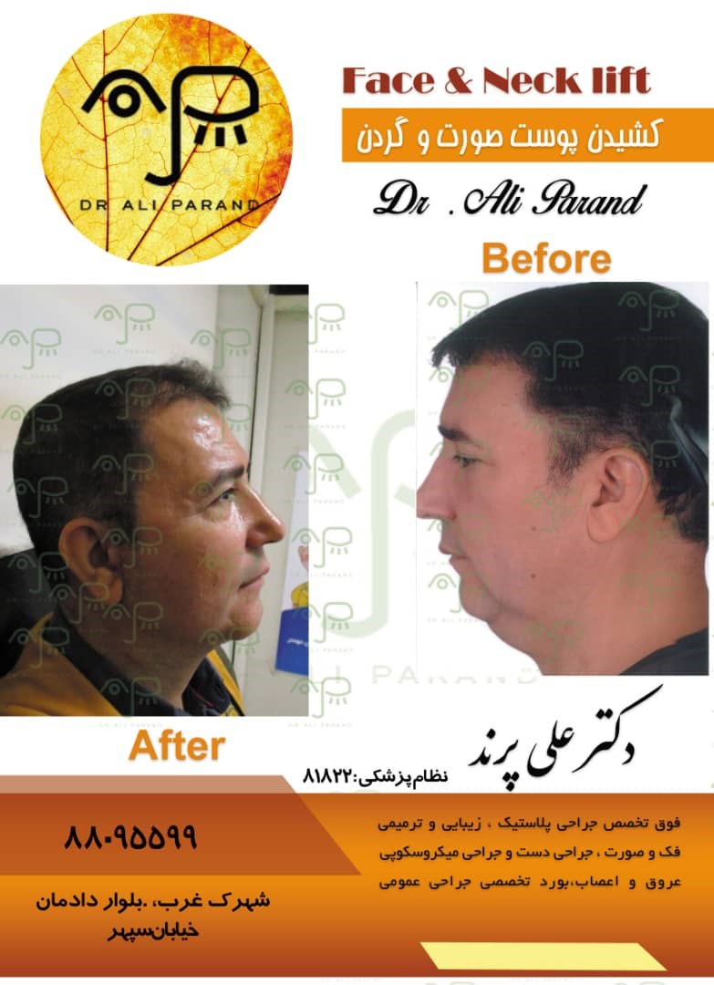 Doctoryab Iran