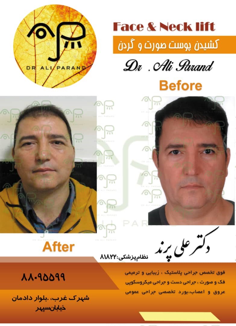 Doctoryab Iran