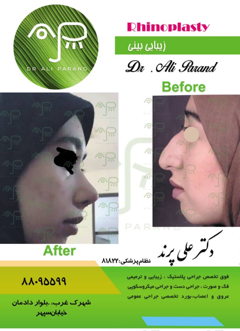 Doctoryab Iran