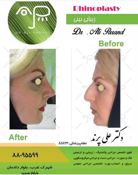 Doctoryab Iran