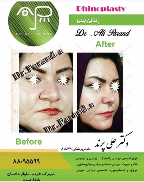 Doctoryab Iran