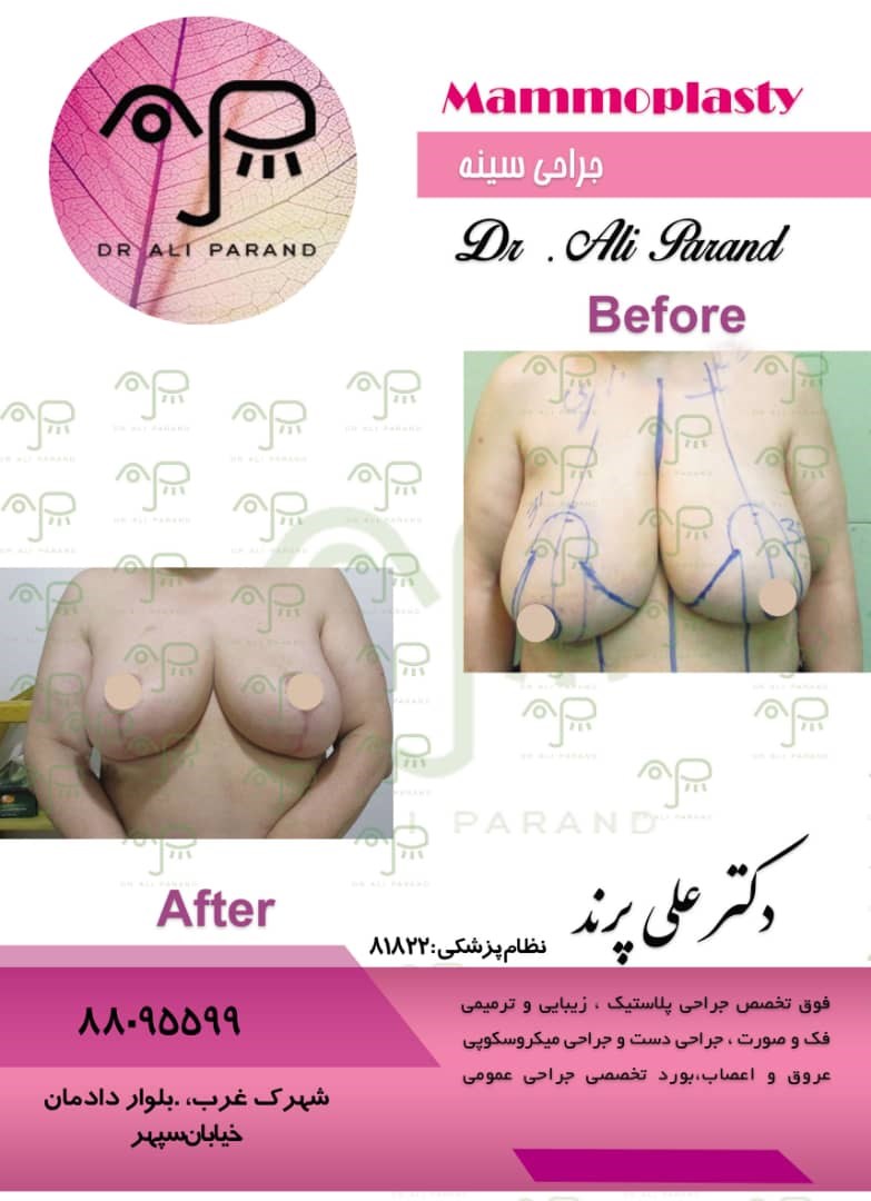 Doctoryab Iran
