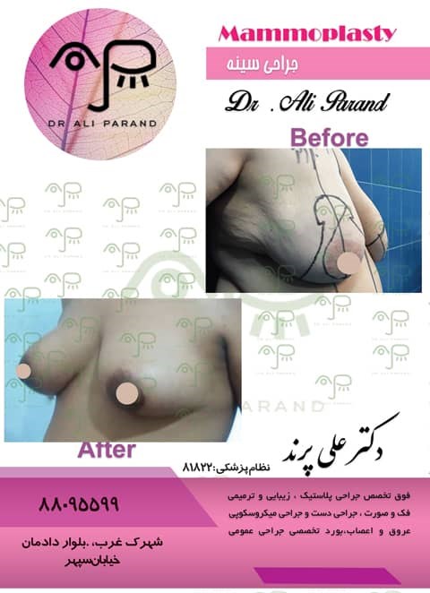 Doctoryab Iran