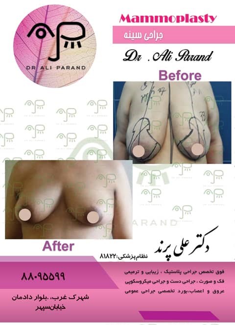 Doctoryab Iran