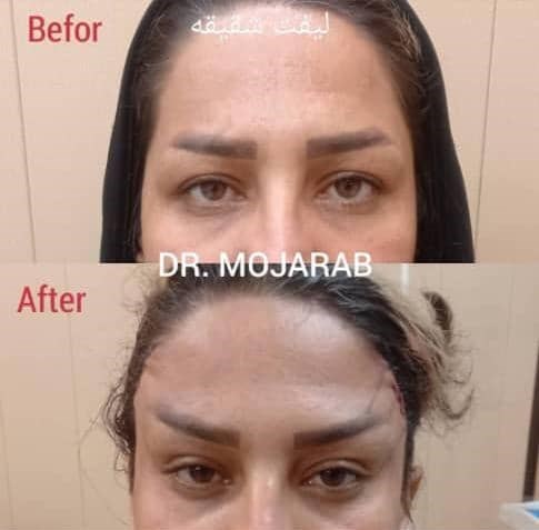 Doctoryab Iran