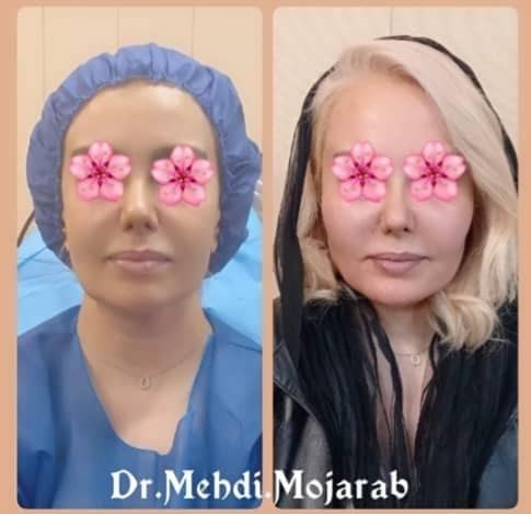 Doctoryab Iran