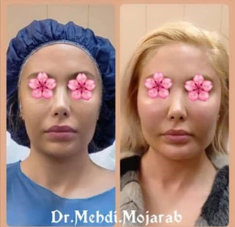 Doctoryab Iran