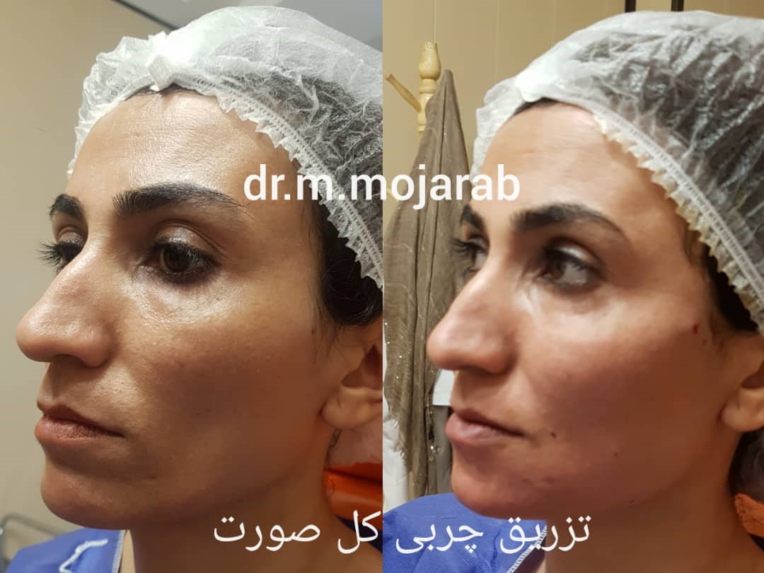 Doctoryab Iran