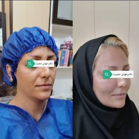 Doctoryab Iran