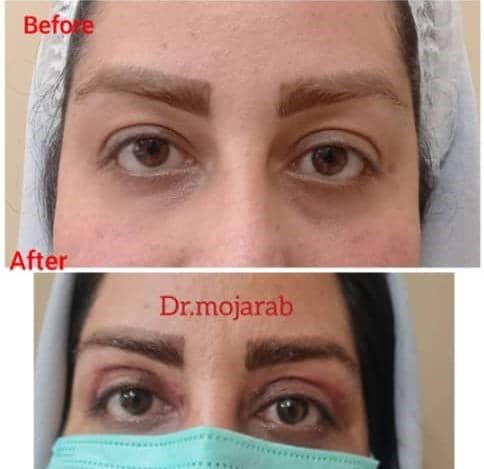 Doctoryab Iran