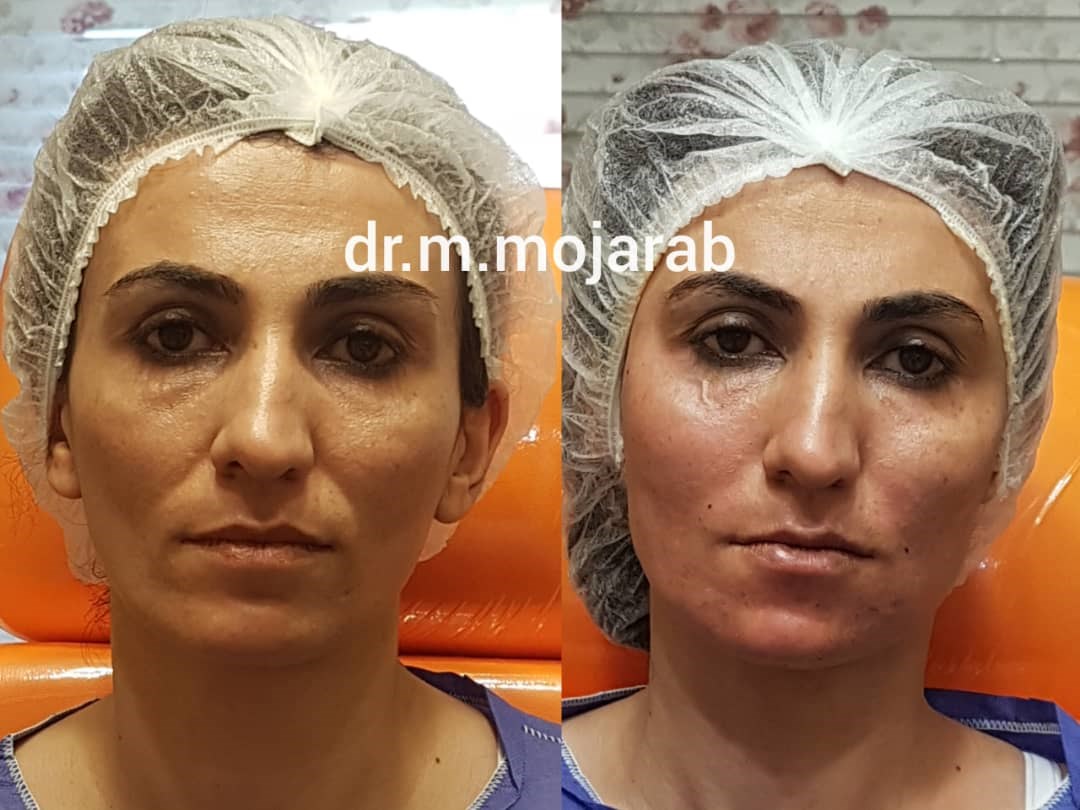 Doctoryab Iran