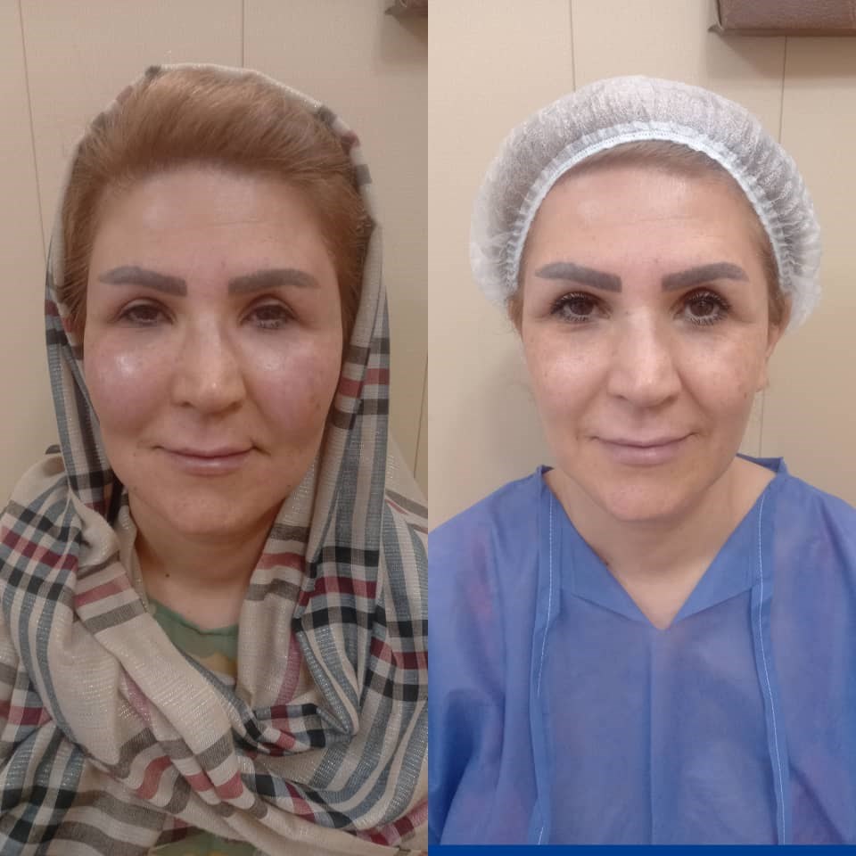 Doctoryab Iran