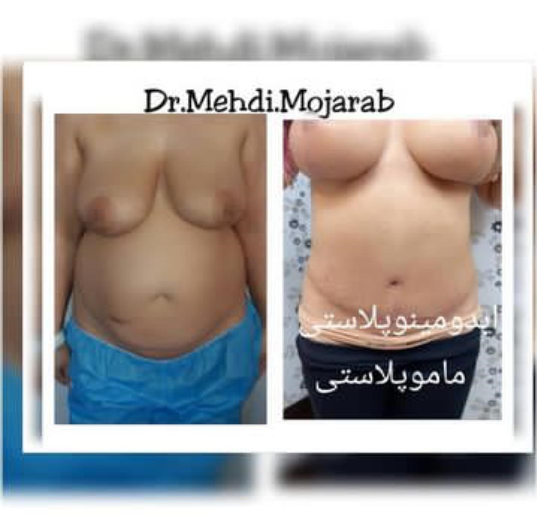 Doctoryab Iran