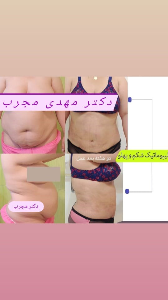 Doctoryab Iran