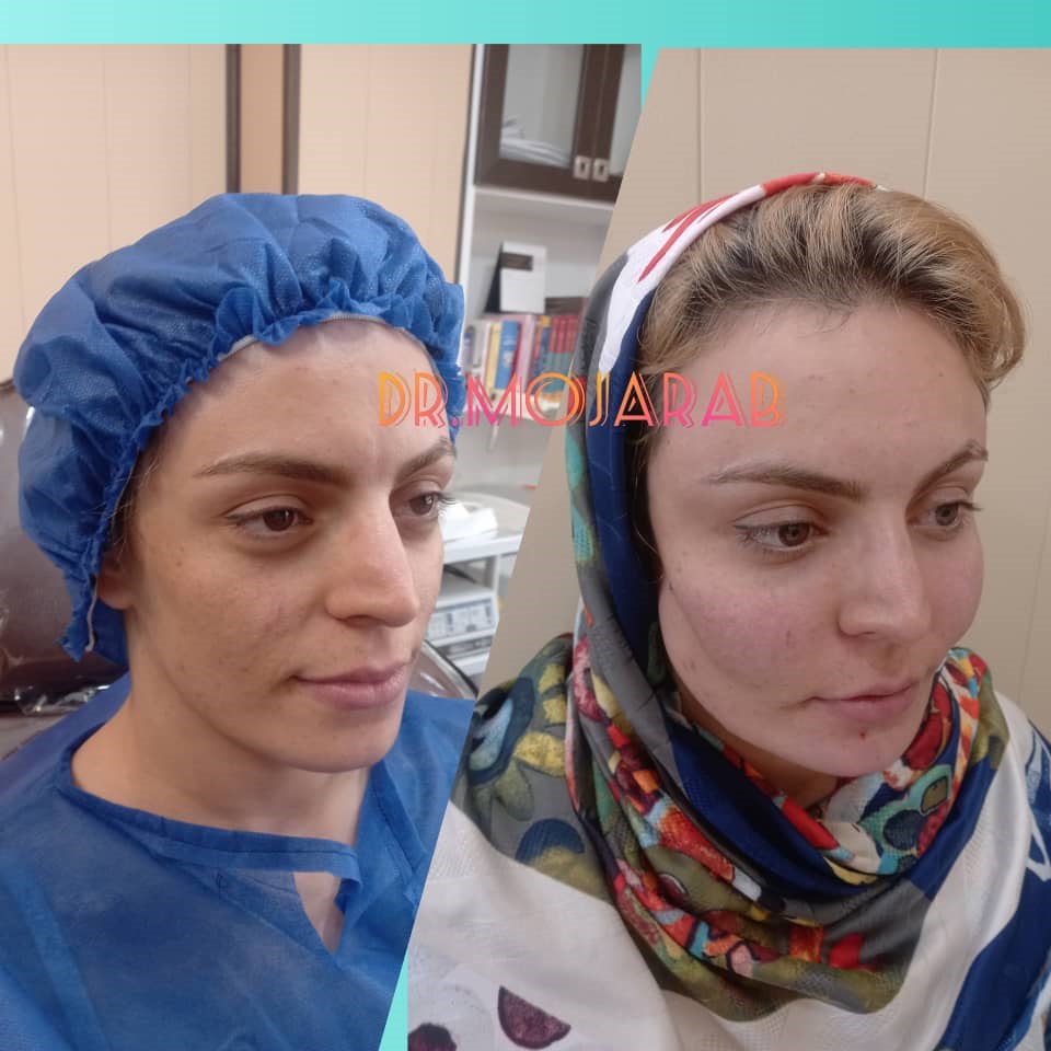 Doctoryab Iran