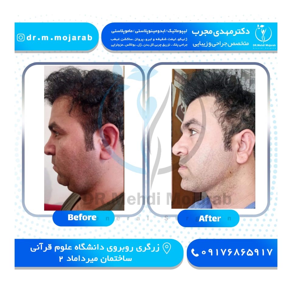 Doctoryab Iran