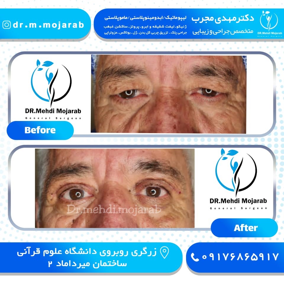 Doctoryab Iran