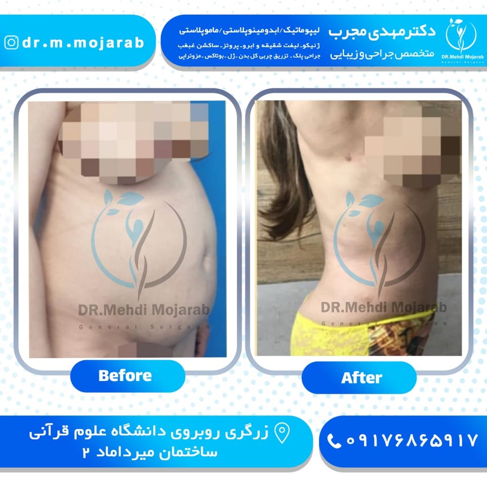 Doctoryab Iran