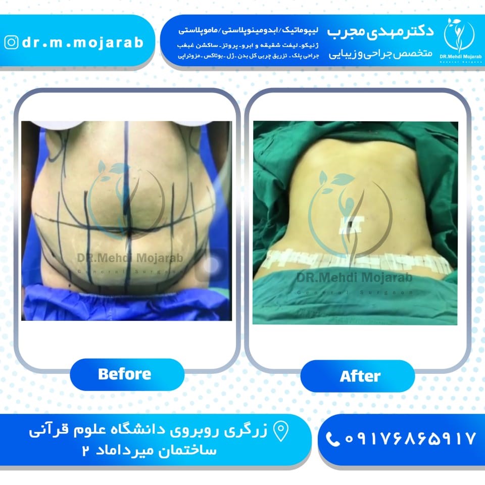 Doctoryab Iran
