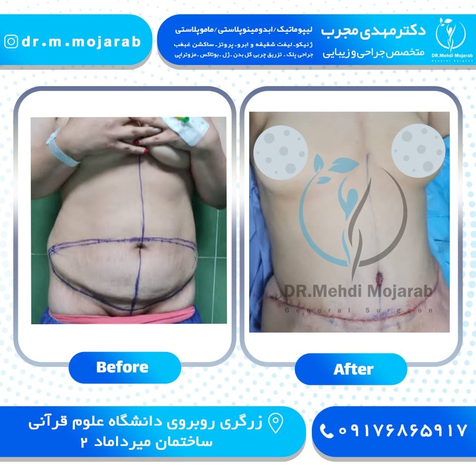 Doctoryab Iran