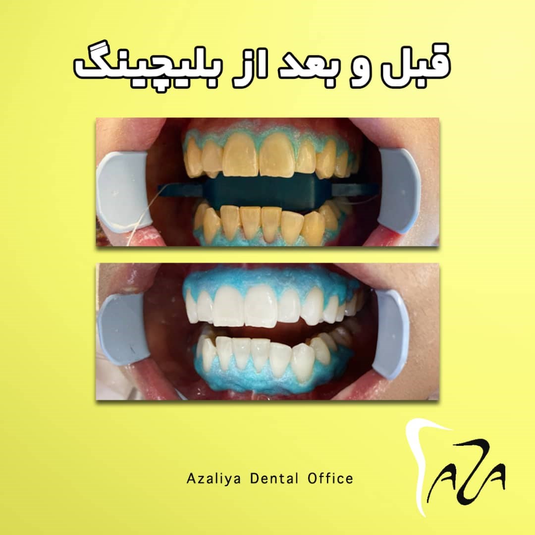 Doctoryab Iran