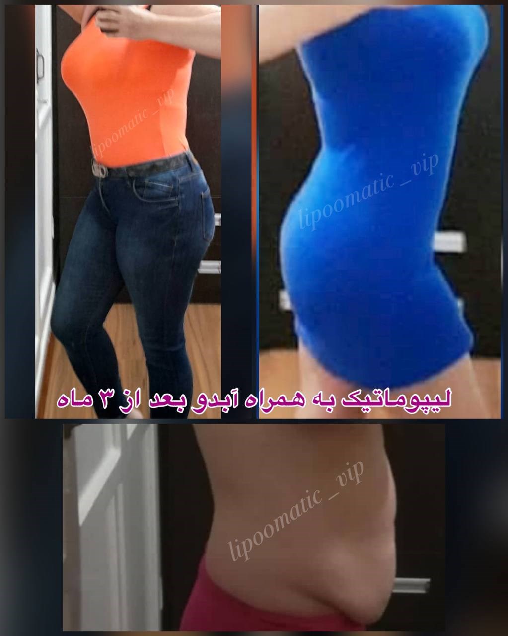 Doctoryab Iran