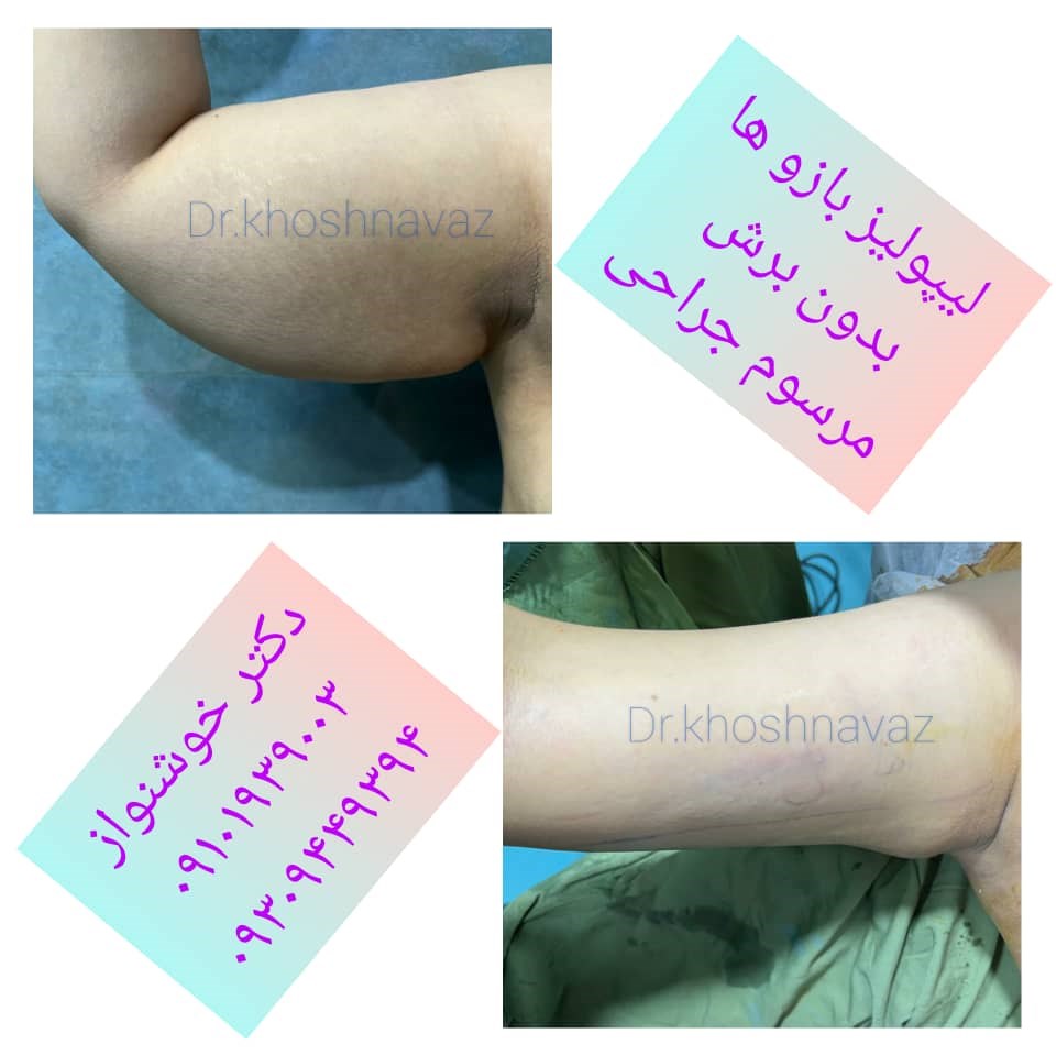 Doctoryab Iran