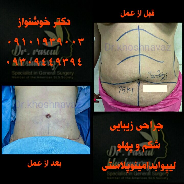 Doctoryab Iran