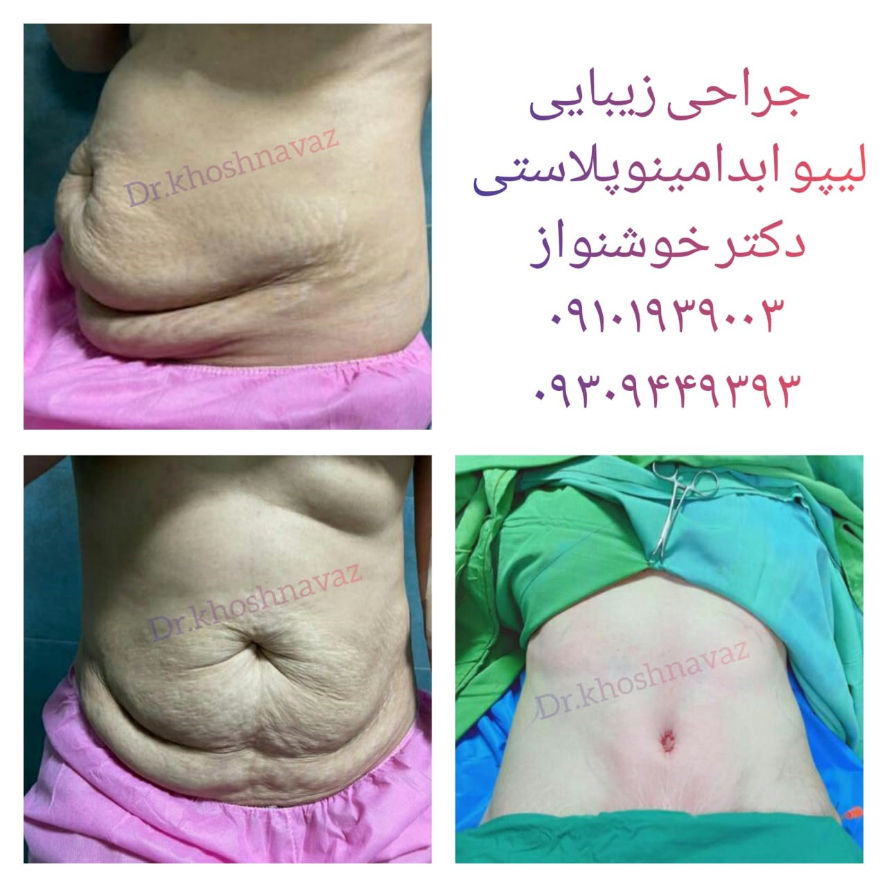 Doctoryab Iran
