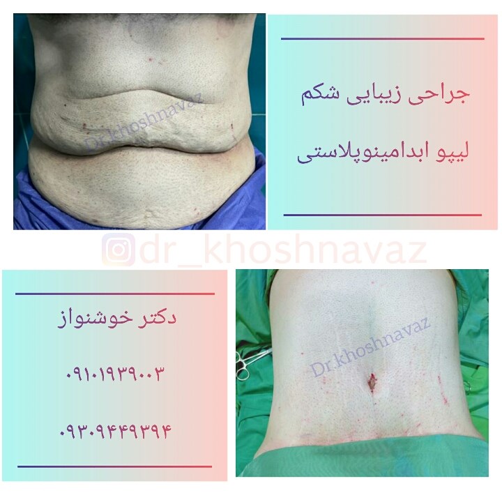 Doctoryab Iran