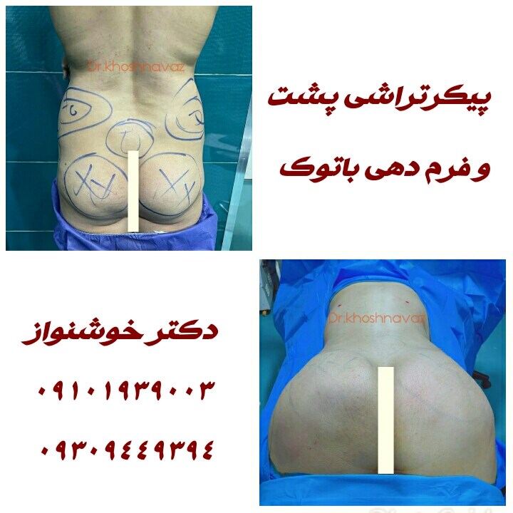 Doctoryab Iran