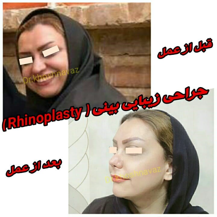 Doctoryab Iran
