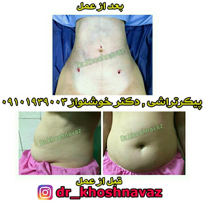 Doctoryab Iran