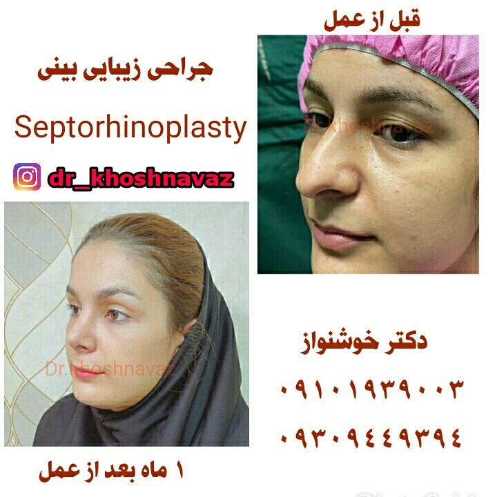 Doctoryab Iran