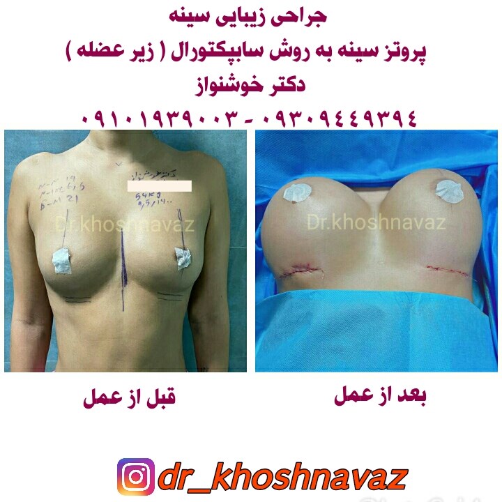 Doctoryab Iran