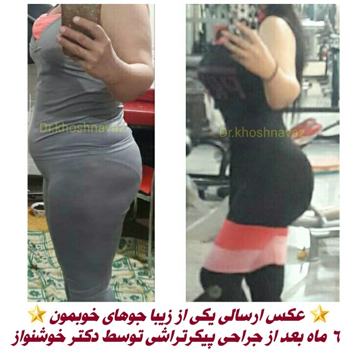 Doctoryab Iran