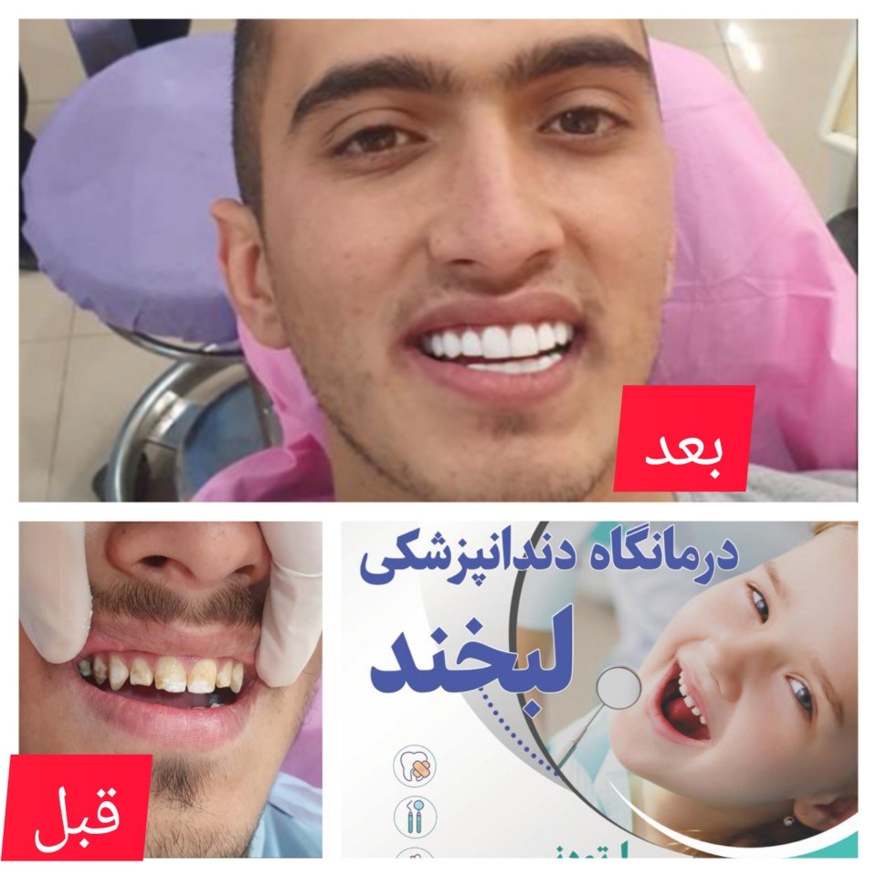 Doctoryab Iran