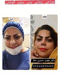 Doctoryab Iran