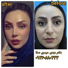 Doctoryab Iran