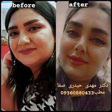 Doctoryab Iran