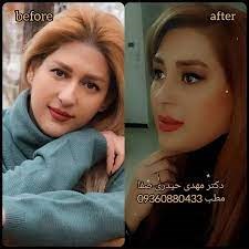 Doctoryab Iran
